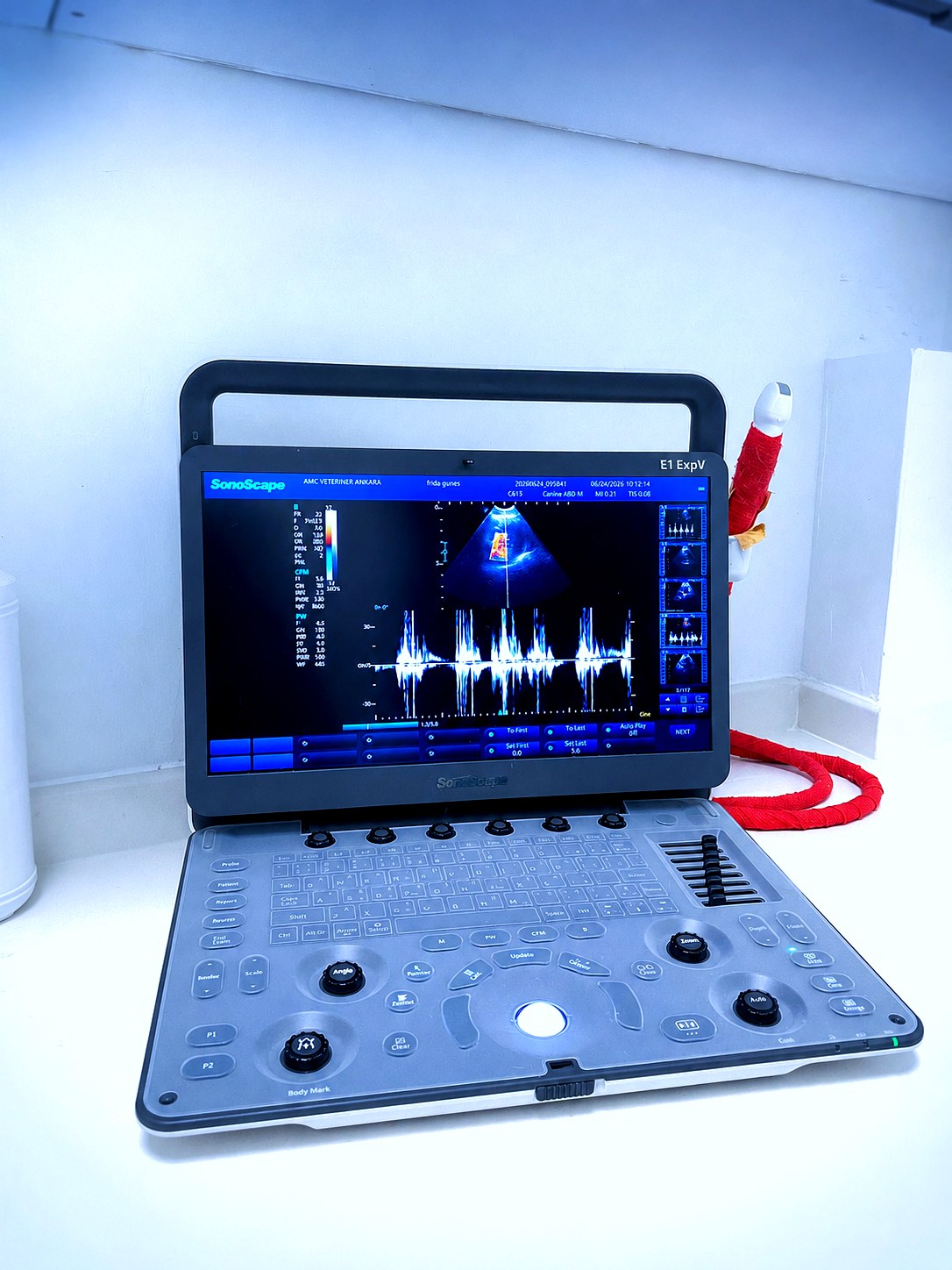 Ultrason